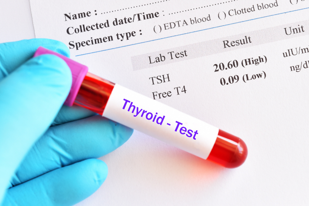 What Happens If Thyroid Not Working Properly